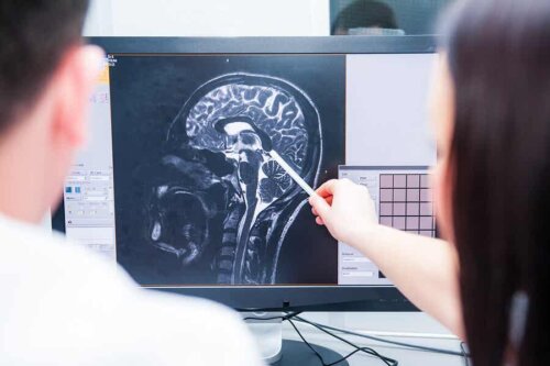 endokrine Disruptoren - zwei Ärzte betrachten Hirn-Scan
