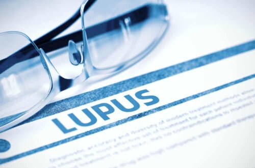 Fragen zu Lupus - Brille über einem Papier mit dem Schriftzug "Lupus"