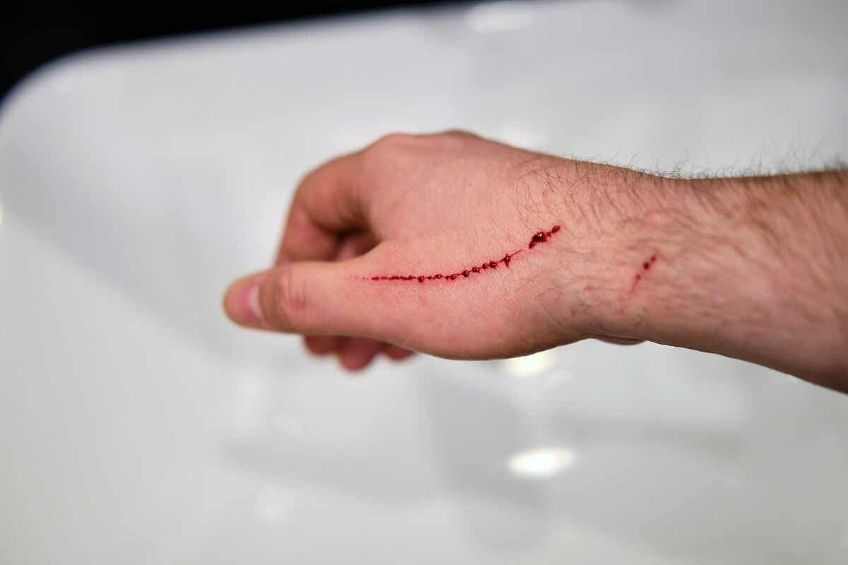 man's arm with a cut on the hand