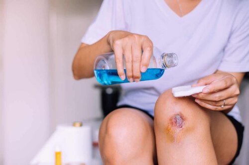 امرأة تعتني بجرح ملوث في ركبتها
