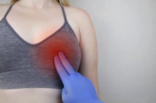 Breast Cysts: What Do They Mean?