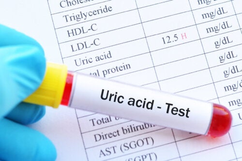 Uric Acid: What Is It and How Can You Control It?