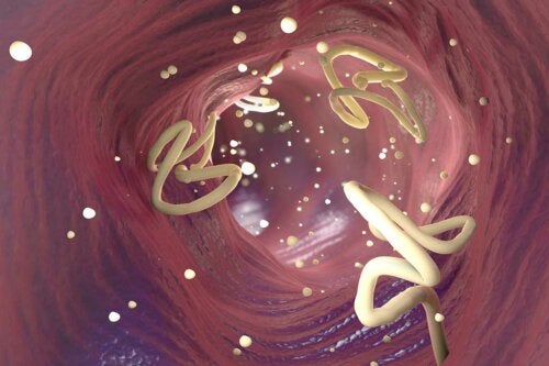 Eliminate Intestinal Parasites with Garlic and Pumpkin Seeds