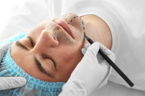 Facial Feminization Surgery: What Is It and What Are the Risks?