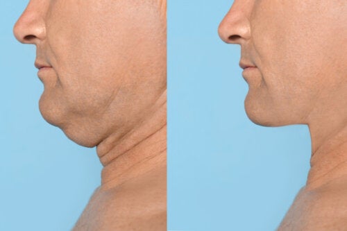 5 Exercises for a Defined Jawline
