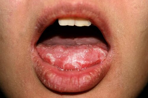 Your Tongue Can Reveal The State of Your Emotions and Health