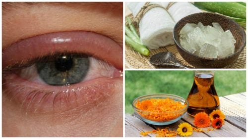 Fight Eye Infections with One of These 9 Remedies