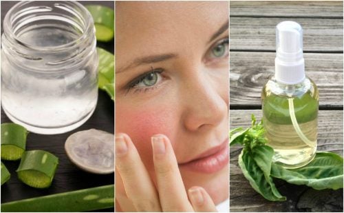 The Top 5 Home Remedies to Soothe Irritated Skin