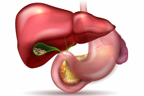 Medicinal Plants to Treat Gallstones