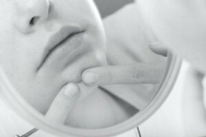 How to Get Rid of Blind Pimples