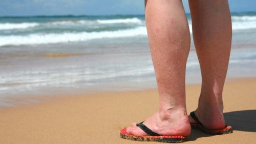 Important! Guidelines to Reduce the Discomfort of Varicose Veins in the Summer