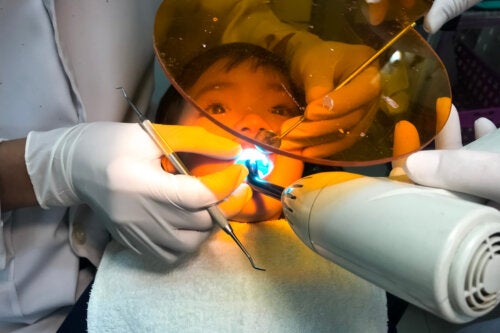What Is Tooth Sealing and What Is it Used For?