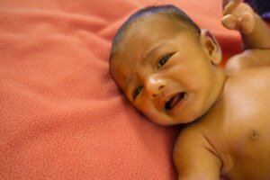 The New Hepatitis Outbreak in Children: Causes, Symptoms, Prevention and Treatment