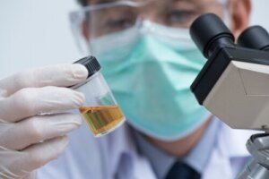 Causes of Foamy Urine and When to Seek Help
