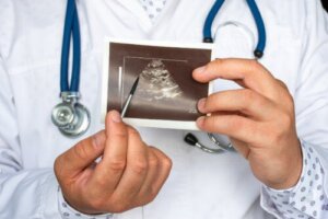 What Is a Pheochromocytoma and What Are Its Symptoms?