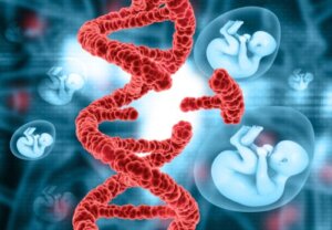 Edwards Syndrome: Symptoms and Causes
