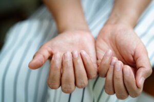 Why Do Stretch Marks Appear on the Nails?