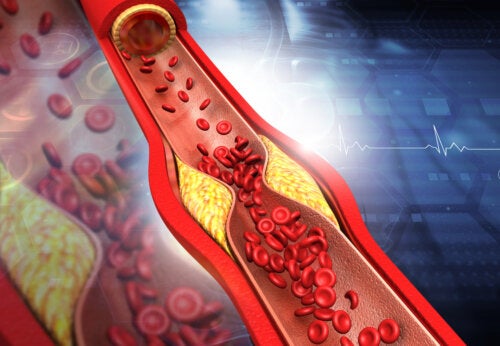 Symptoms and Tips for Raising HDL Cholesterol Levels