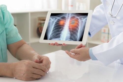 A Spot on the Lung: Main Causes and Treatment