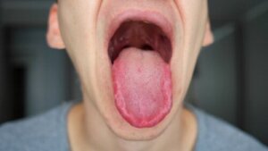 Numb Tongue? Check Out These 18 Possible Causes
