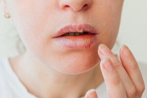 Treatment for sore throats
