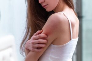 What Do Flea Bites Look Like and How Long Do They Last?