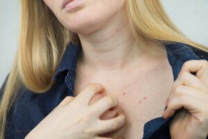 What Are the Most Frequent Adverse Reactions to Cosmetics?