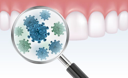 Everything You Need to Know About Dental Bacterial Plaque
