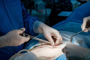 Skin Grafting: When Is It Used?