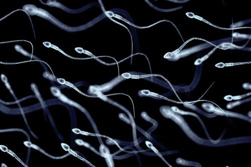 Necrospermia: The Causes of Sperm Death