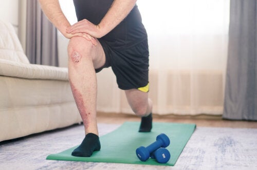 The Benefits of Physical Exercise for Psoriasis