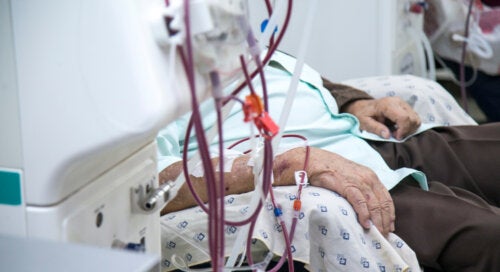 What Is Therapeutic Apheresis?