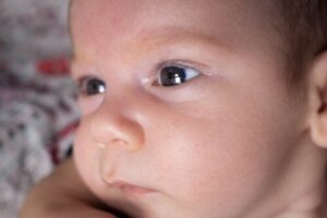 Aniridia or Absence of the Iris: Why Does it Occur?