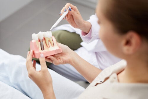 What Are Dental Implants and What Are They Used For?