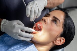 Acid Etching: What Is this Dental Procedure?