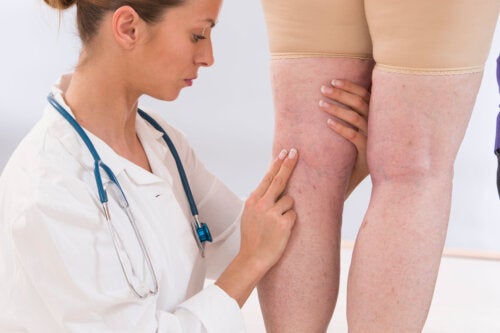 11 Symptoms of Poor Circulation in the Legs and Feet