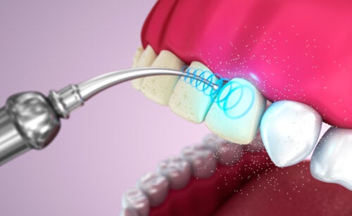 Ultrasonic Tooth Cleaning: The Advantages and Disadvantages