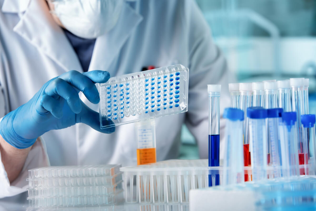 Elisa blood test.