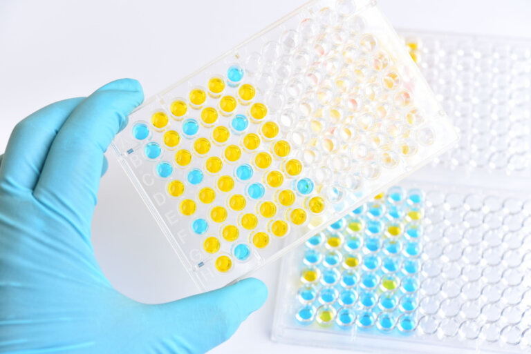 The ELISA Blood Test: What It's For and How It's Done