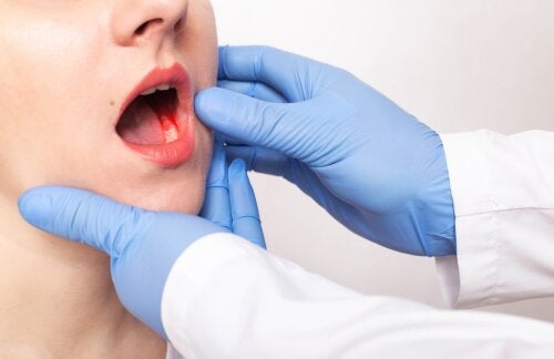 The Symptoms and Causes of Periodontitis