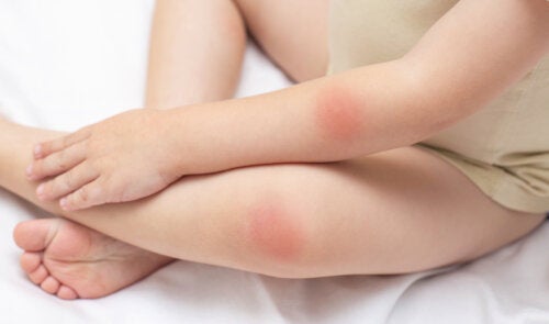 Red Spots on the Skin: 25 Possible Causes and Treatments
