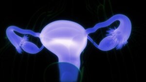 Ovarian Dermoid Cysts: Symptoms and When to See a Doctor