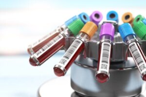 A New Blood Test that Detects Tumors Before Symptoms Occur
