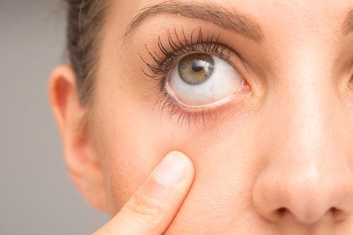 7 Tips for Treating Eye Tic Disorder