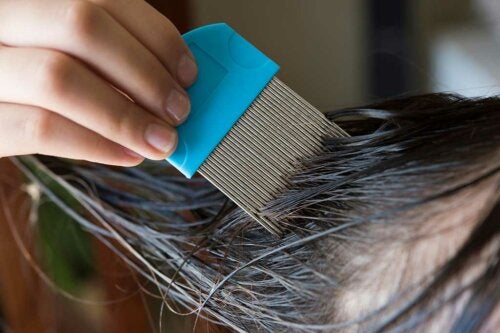 How to Get Rid of Head Lice Naturally