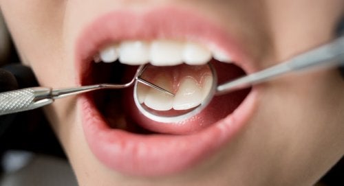 7 Consequences of Poor Dental Hygiene for Your Health