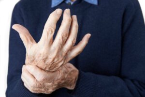 7 Myths about Food and Arthritis