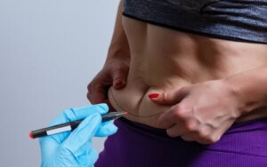 BodyTite, The Technology to Reduce Body Flaccidity