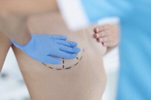 Mastopexy: The Benefits and Risks of Breast Augmentation
