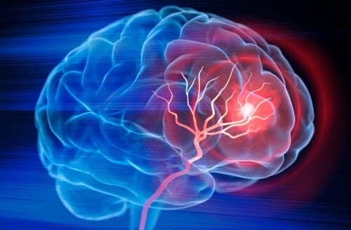 World Stroke Day: A Few Minutes Can Save Lives